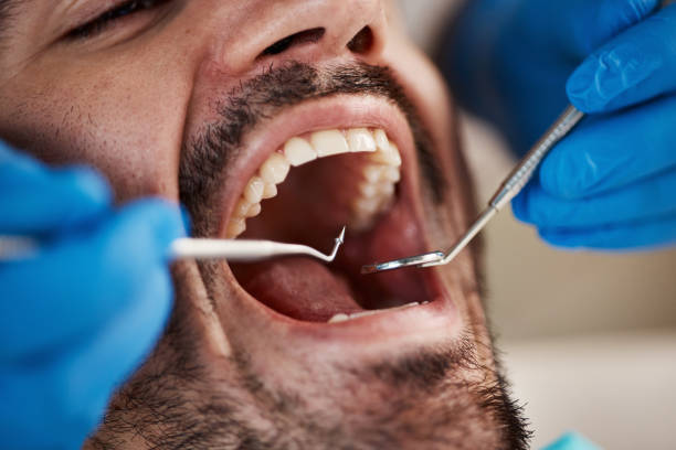 Best Emergency Denture Repair in Gulfport, MS
