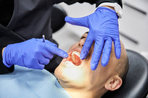 Best Emergency Dental Care for Sports Injuries in Gulfport, MS